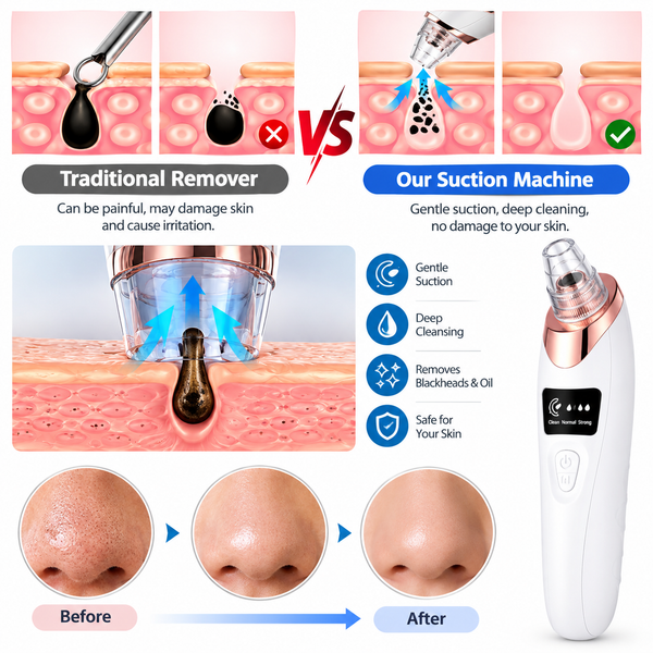 5-in-1 Rechargeable Blackhead Remover Machine